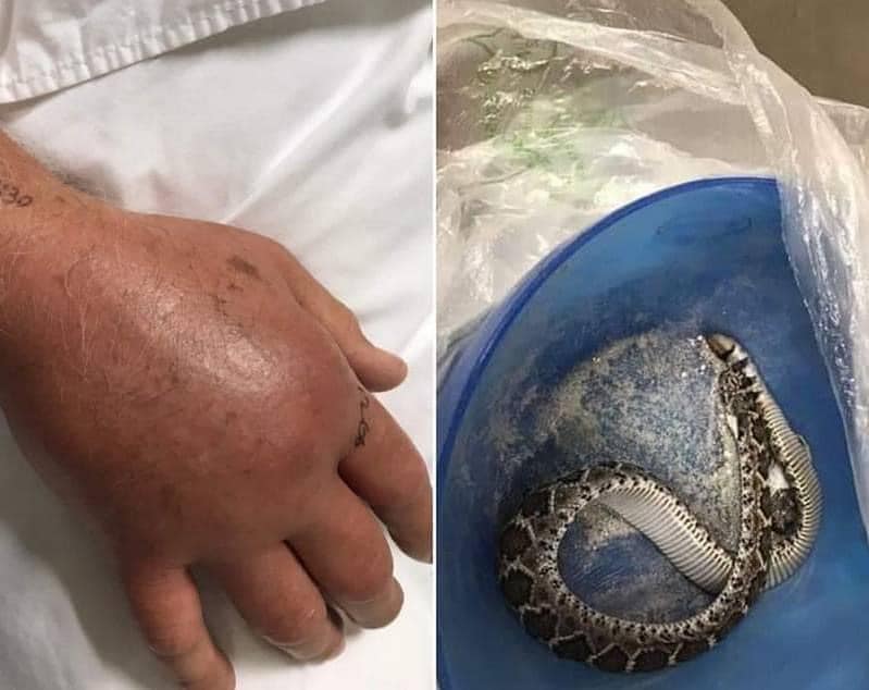 Calor saca a serpientes de su hábitat en Tamaulipas; crecen hospitalizaciones por mordedura