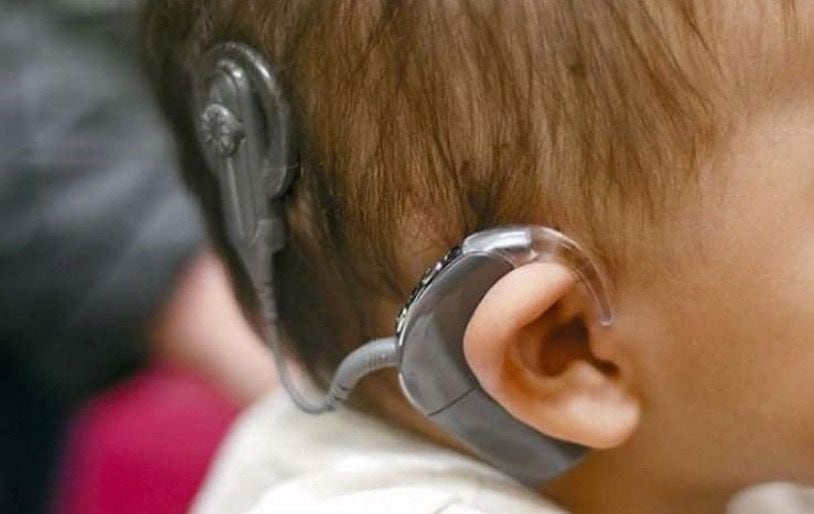 Implantes cocleares en el IMSS para niñez con problemas auditivos, un logro que comenzó con un amparo gratuito