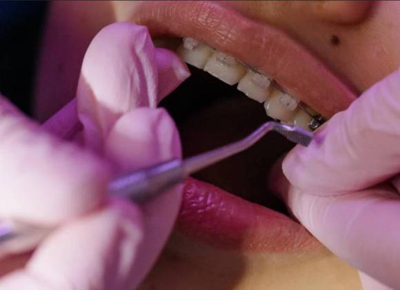 Coahuila: Especialízate en Ciencias Odontológicas con acentuación en Ortodoncia; la UAdeC impartirá maestría