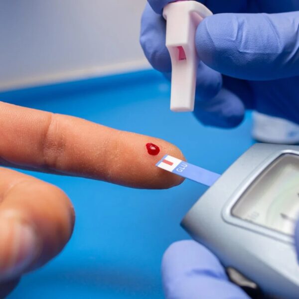 Tamaulipas registra 1,036 nuevos diagnósticos de diabetes tipo 2 en el segundo trimestre de 2025